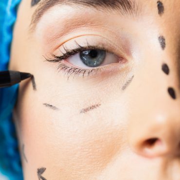 plastic surgery